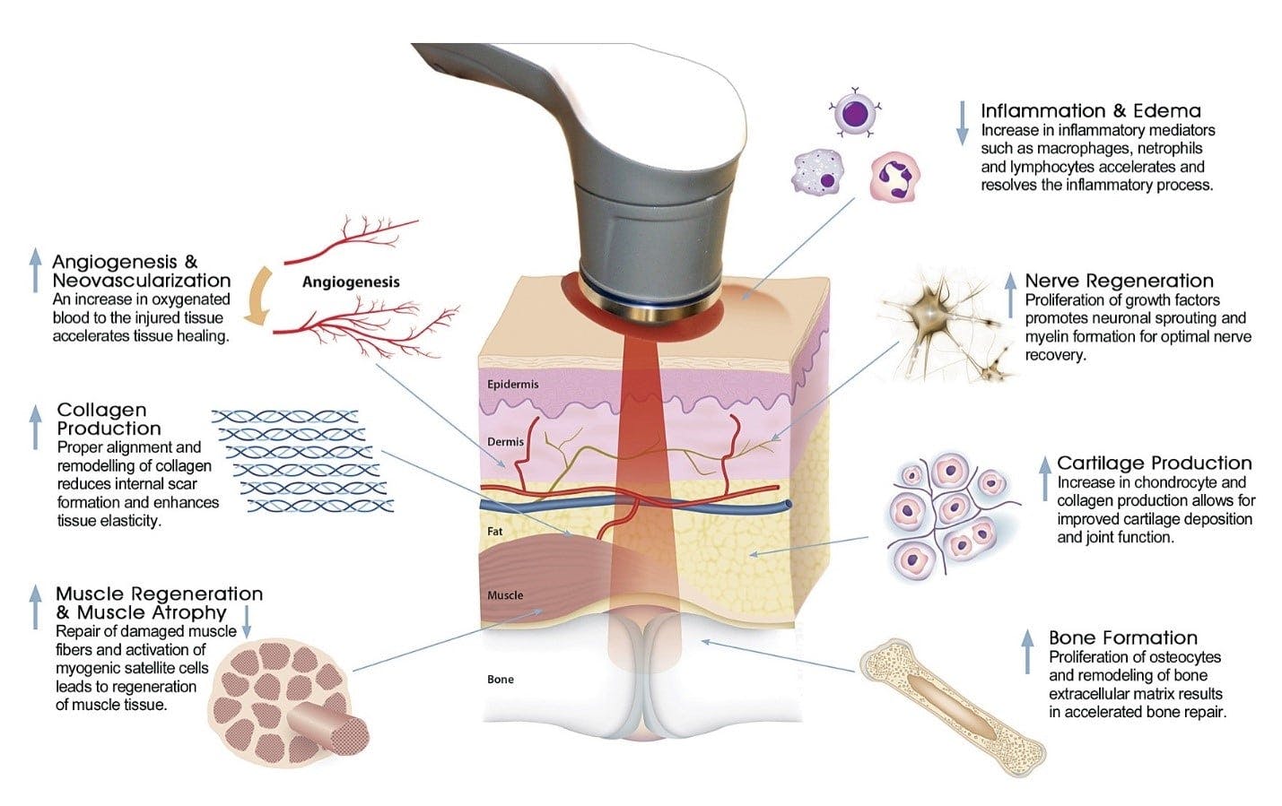 class iv therapeutic laser