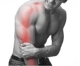 Cervical Radiculopathy causing elbow pain