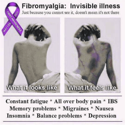 Fibromyalgia: Invisible Disease