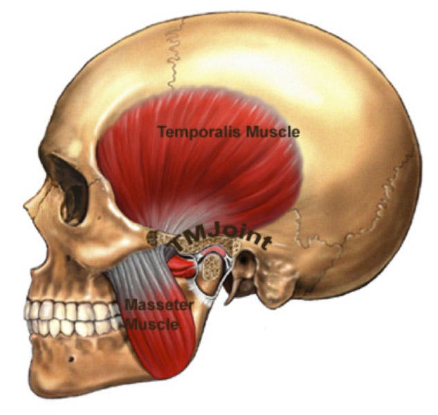 TMJ (Temporomandibular Joint)