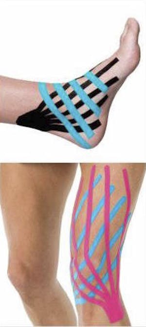 What is Kinesio Tape? — LIGHTHOUSE FOOT & ANKLE CENTER