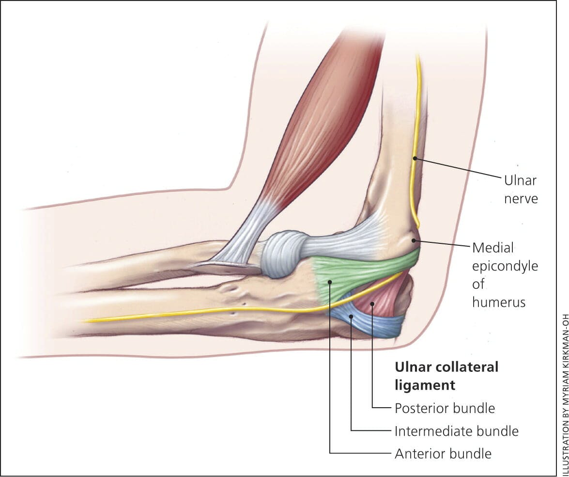 Medial Ulnar Collateral Ligament Tear