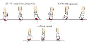 foot pronation and supination chart
