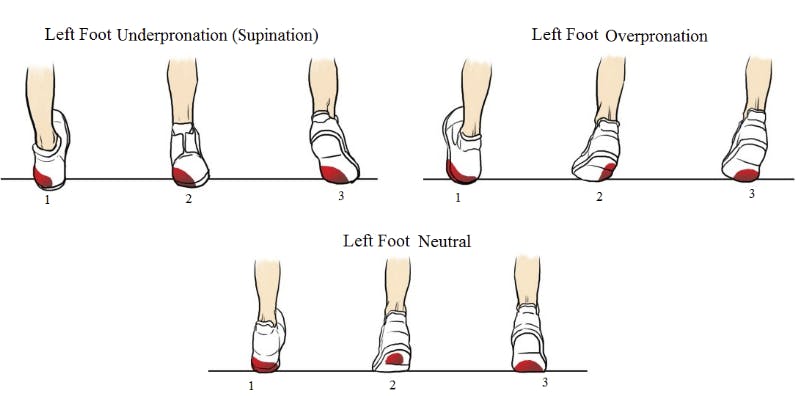 foot pronation and supination chart