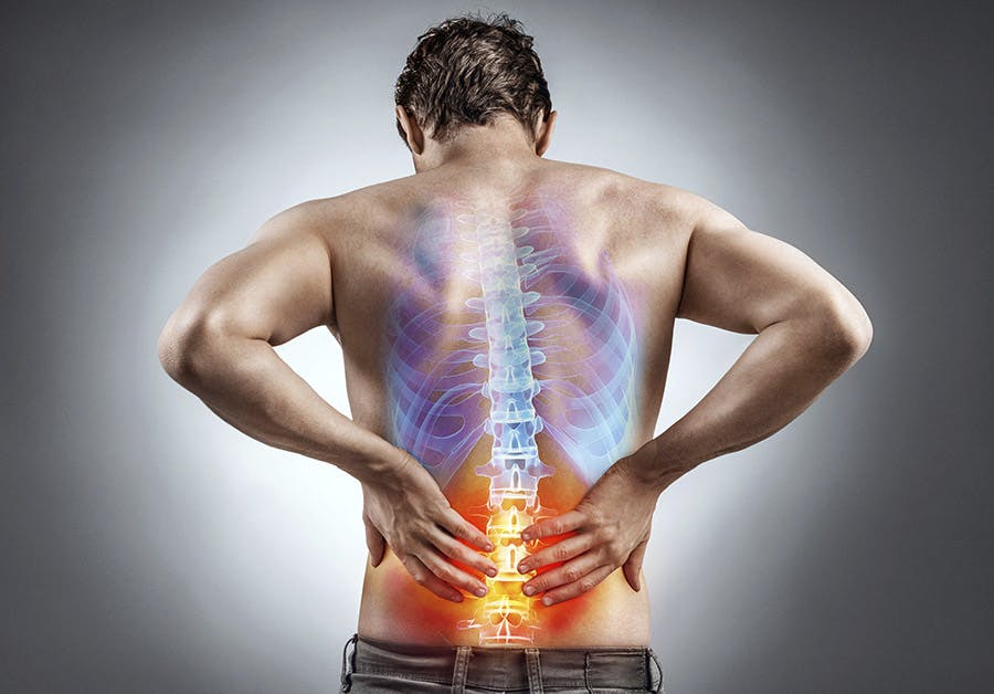 Low Back Pain - Impact Physical Therapy