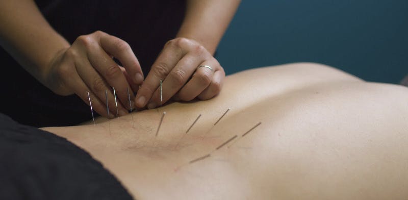 Boston Physical Therapy & Wellness | Dry Needling | Medford MA