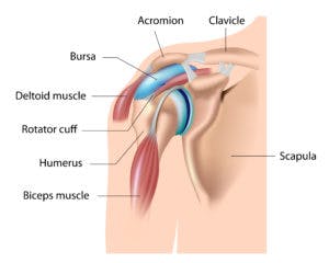 rotator cuff impingement