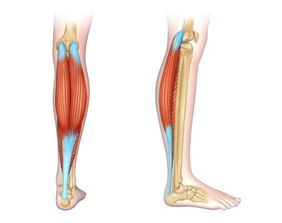 leg muscle strain