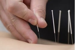 InMotion Physical Therapy | Trigger Point Dry Needling