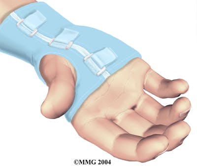 Diagram of a Wrist Brace