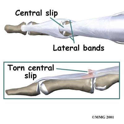 Diagram of Central Slip