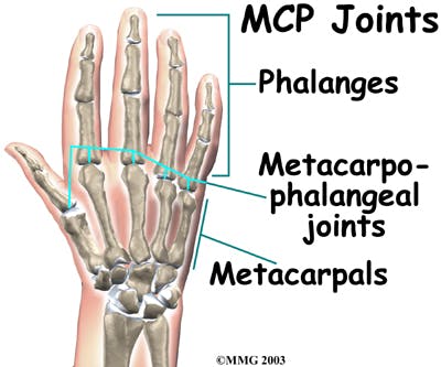 Diagram of Metacarpophalangeal (MCP) Joints