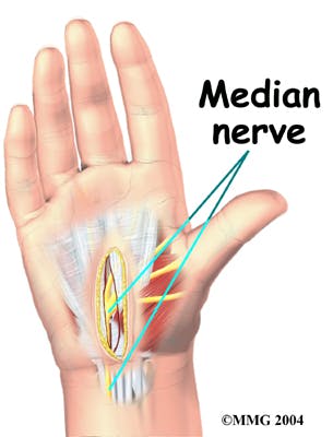 Diagram of Median Nerve Protected