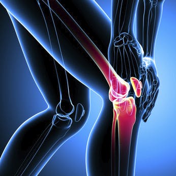 Unguent cremă pentru artroza genunchiului