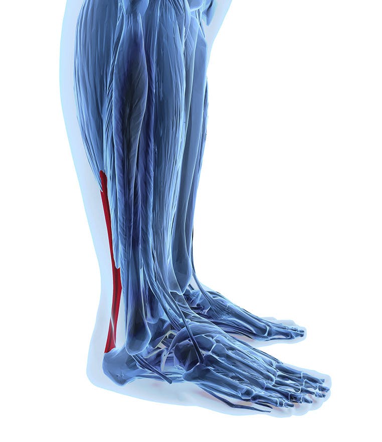 Pain from Achilles tendonitis