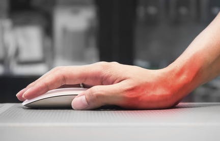 Carpal Tunnel Syndrome from Computer Work