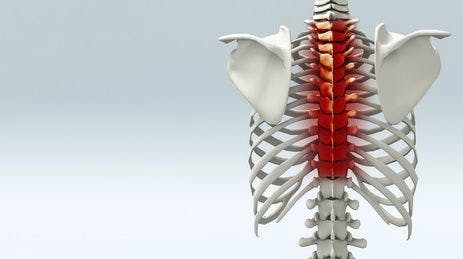 Upper Back Therapy Treatment Portland