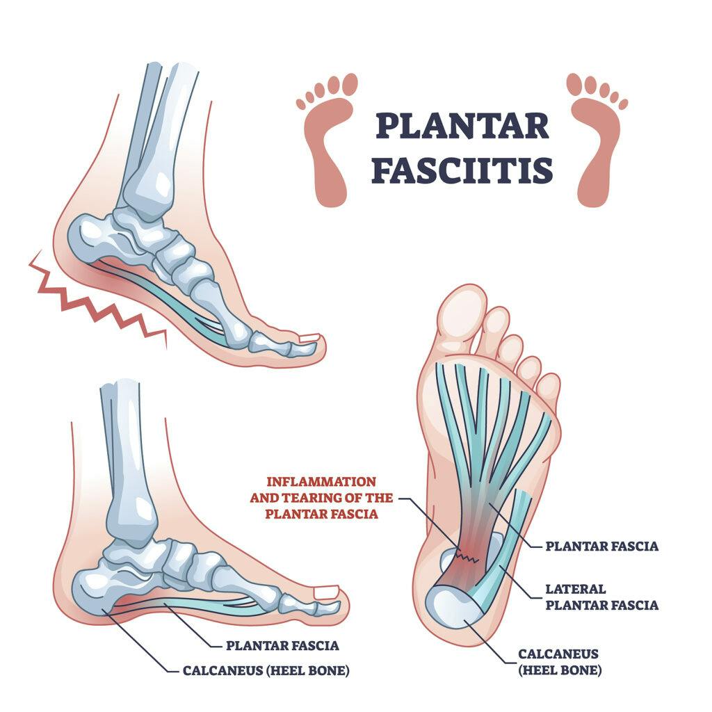 Foot/Ankle Pain • Rising Tide Physical Therapy