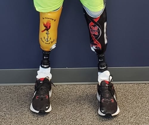 New Horizons Orthotic & Prosthetic Services