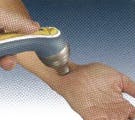 Low-level Laser Therapy