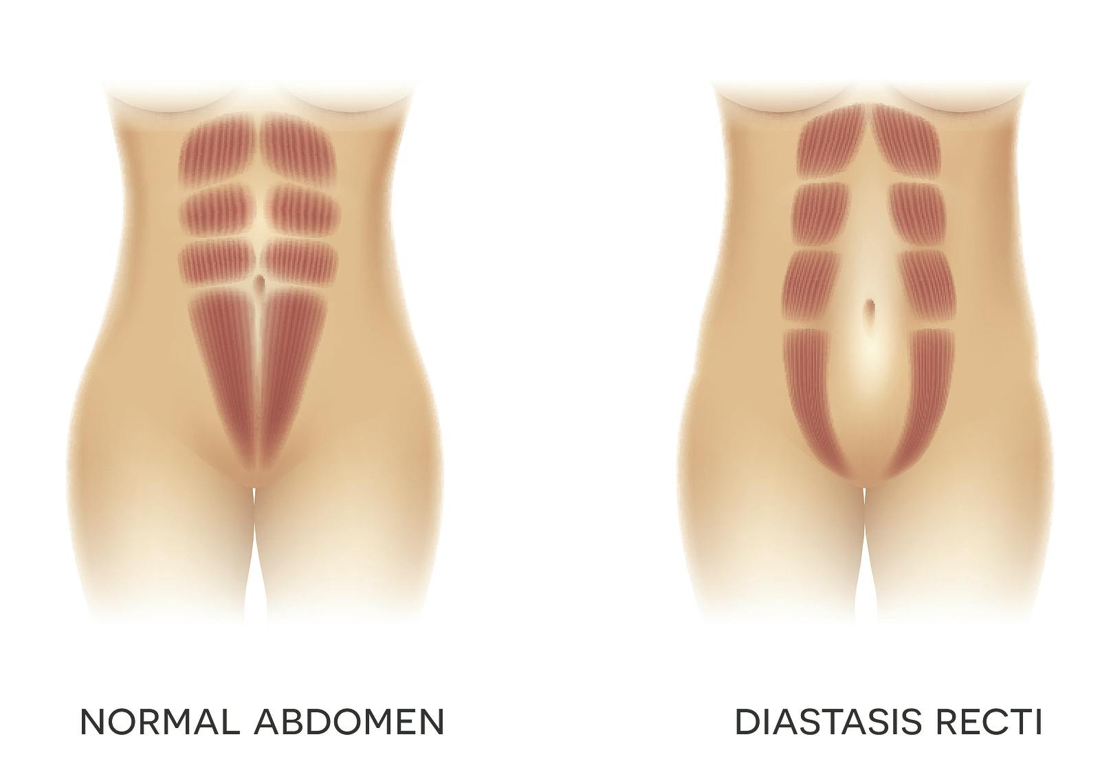 Physical Therapy Grand Rapids MI