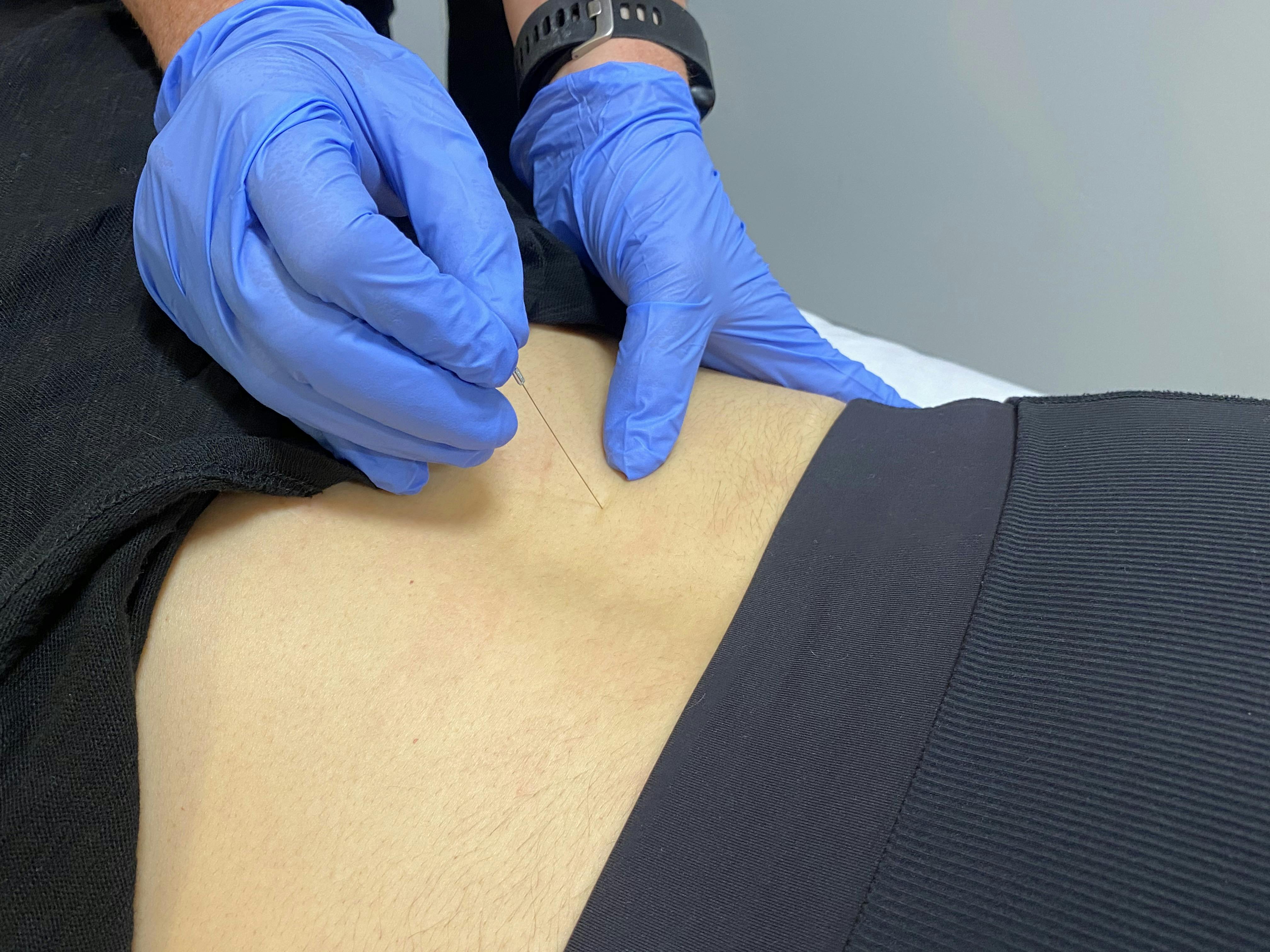 physiotherapy Kitchener ON