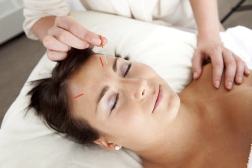 Physiotherapy and Acupuncture: The Perfect Pain Relief Pair