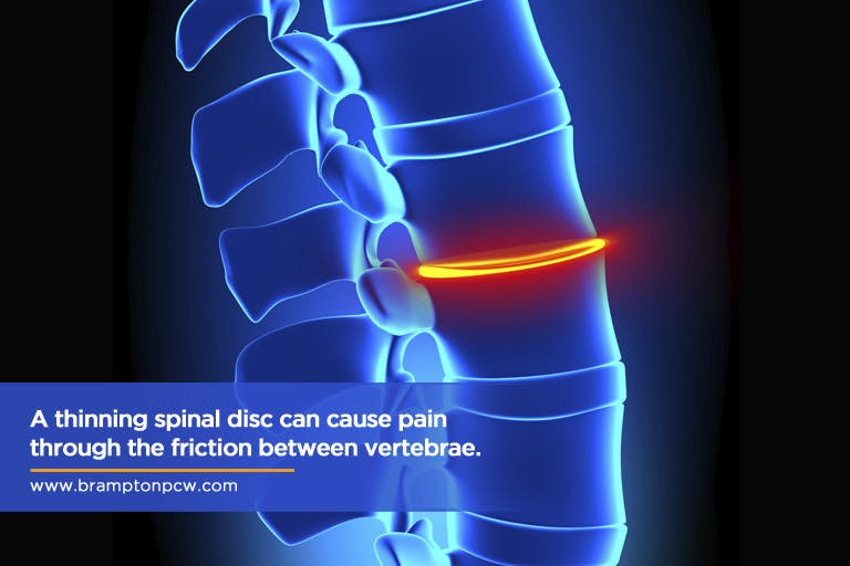 A thinning spinal disc can cause pain through the friction between vertebrae.
