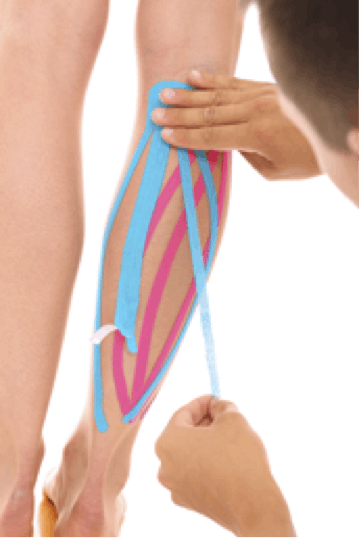 Jump Start Physical Therapy | Kinesio Taping | Natick | Norwood | Newton