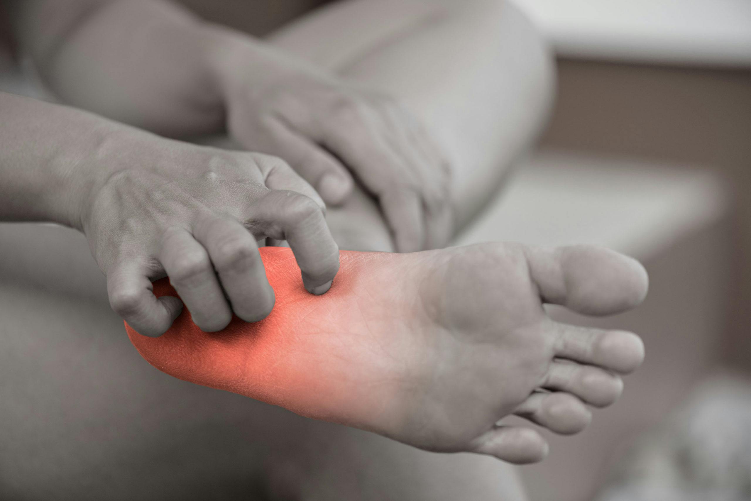 Case Study - Treatment Of Heel Pain Due To Plantar Fasciitis
