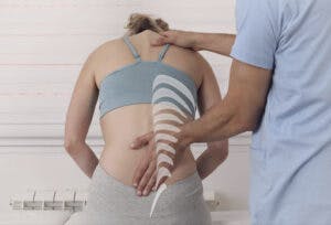 chiropractic for posture correction