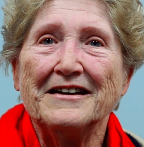 physical therapy Covington LA