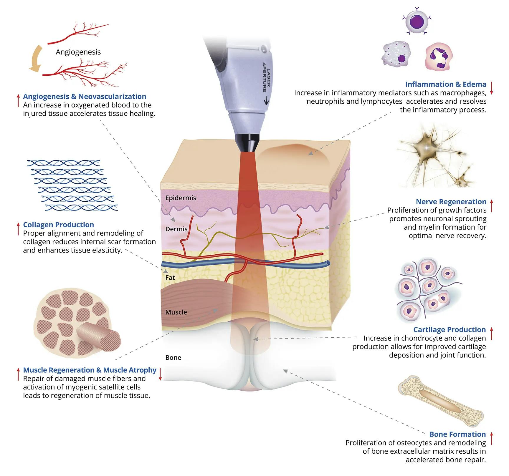 Image showing the clinical effects of laser therapy
