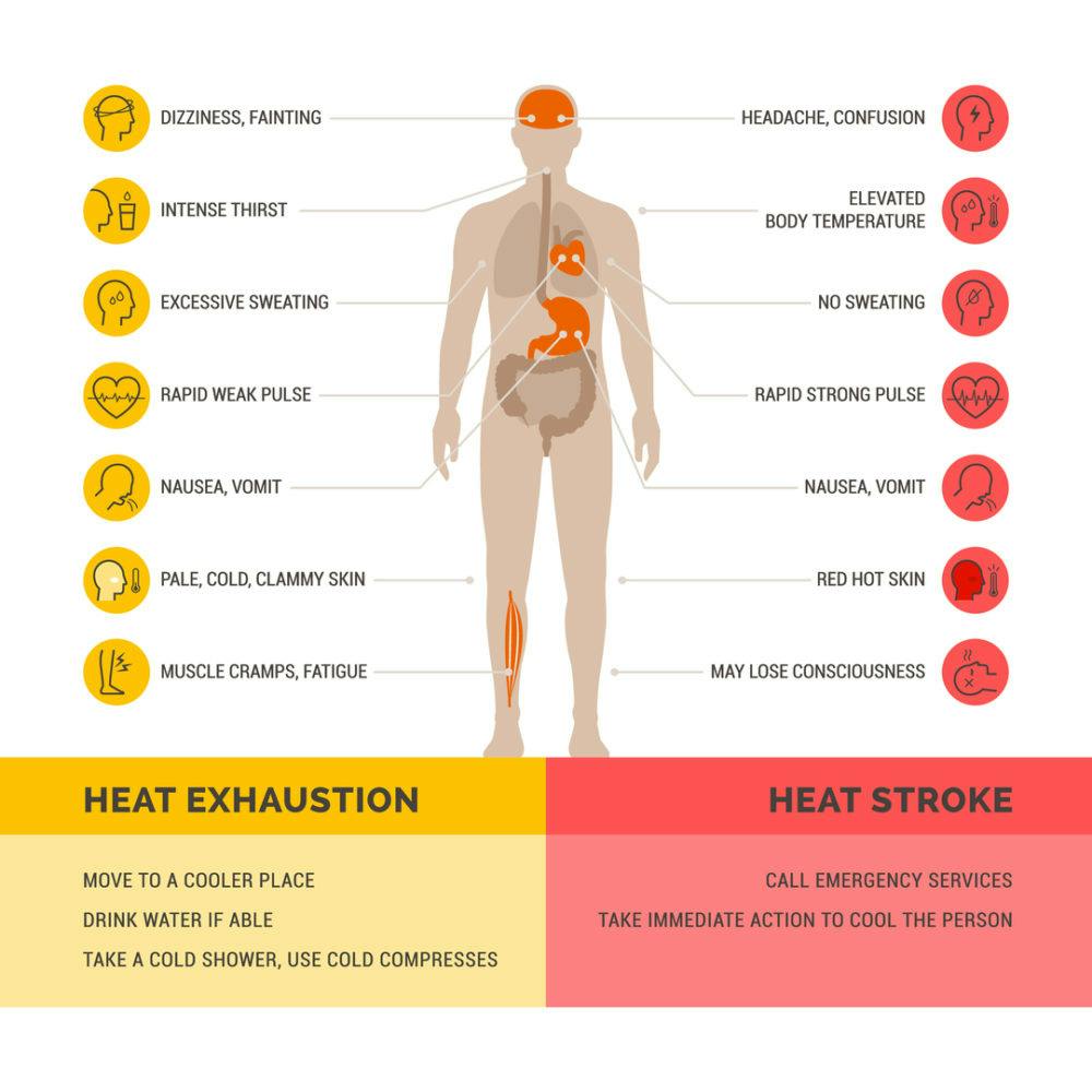 Heat Illness: Dangers of Youth Sports in the Summer Heat