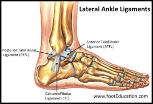 Lateral ankle sprains