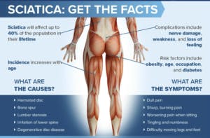 Sciatica Pain Relief Part 2: Common Causes of Sciatica — Revive Sport &  Spine