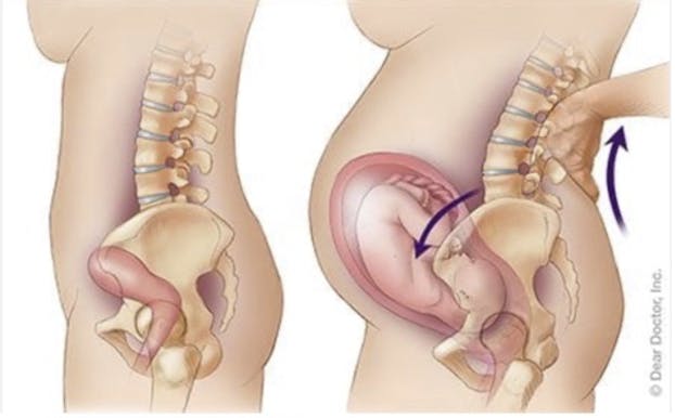 Diagram of Why Pelvic Girdle Pain (PGP) Occurs