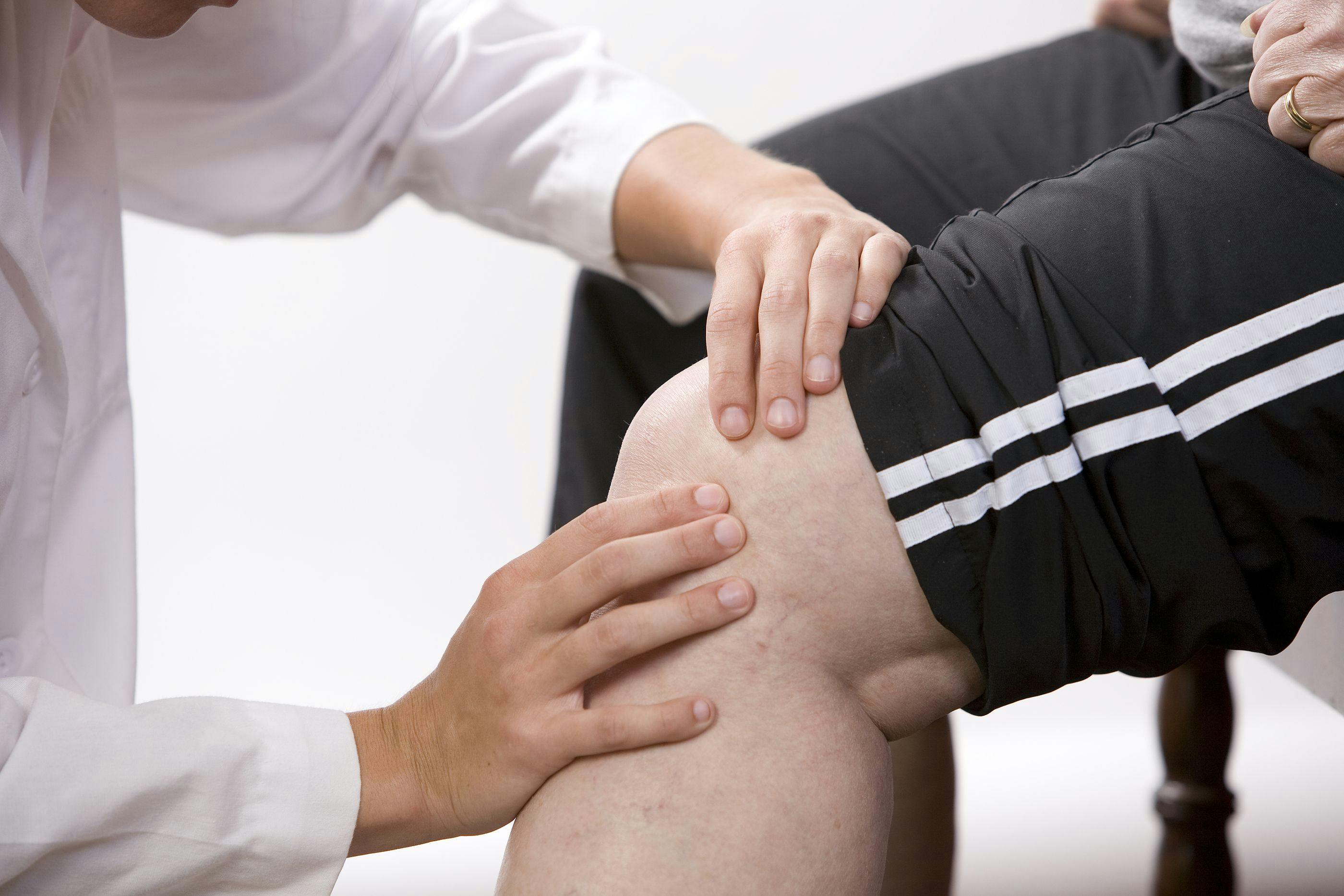 physical therapy Irvine CA