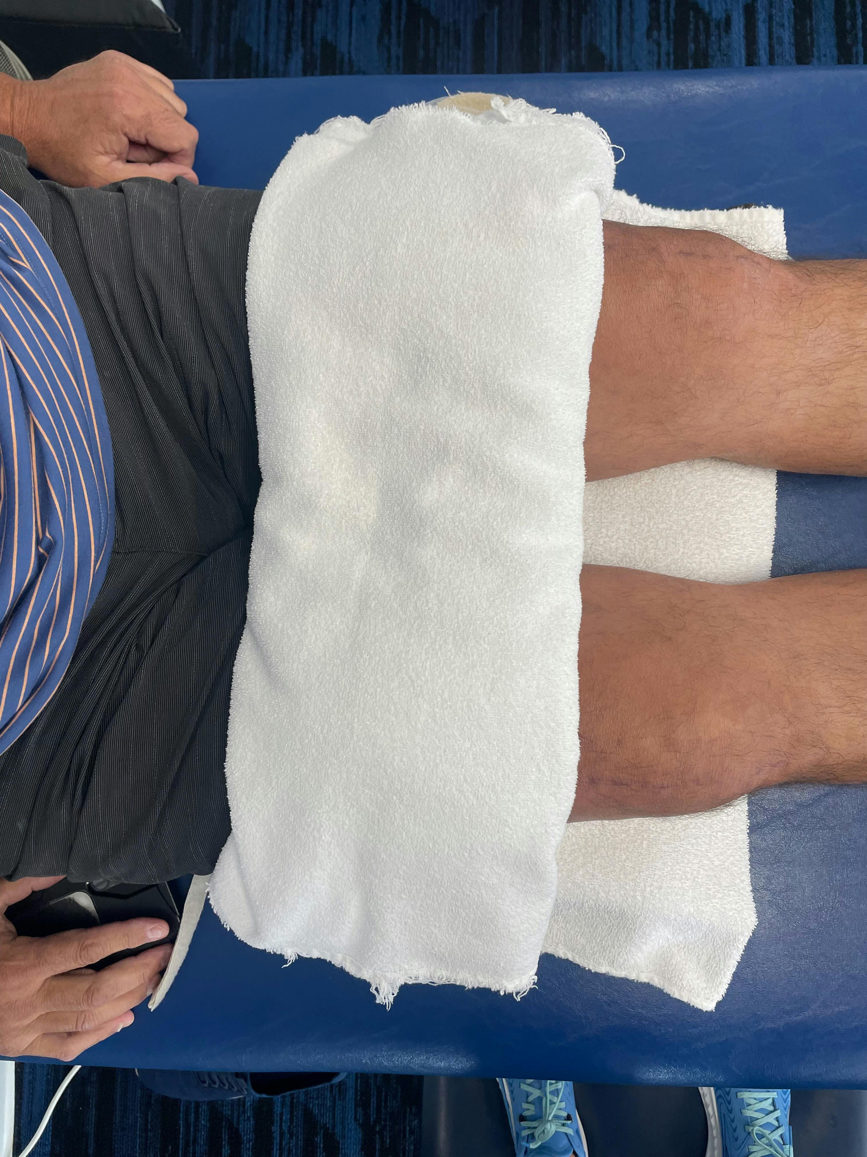 physical therapy spring valley ca