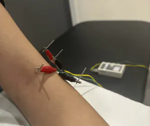 is a modern acupuncture technique where fine needles are inserted into specific body points, then connected to a device that sends mild electric currents, enhancing traditional effects like pain relief, improved blood flow, and muscle function by stimulating nerves and balancing Qi (energy)