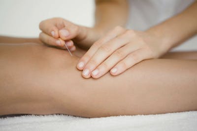 Intramuscular Stimulation
