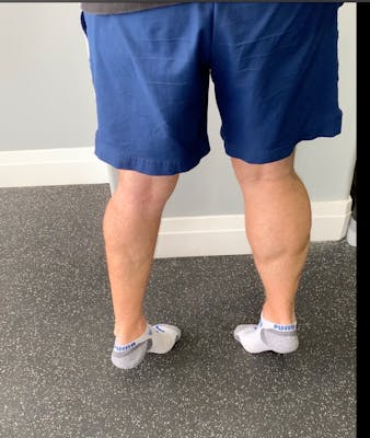 physiotherapy Peterborough Ontario