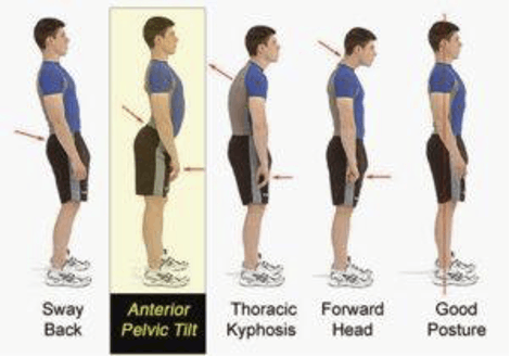 How your glutes are essential for a healthy core and proper spine posture -  Straightline Fitness & Rocky Mountain Recovery